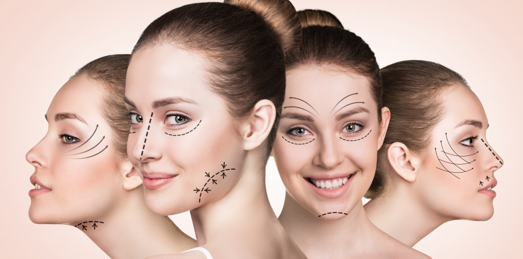 Various forms of facelift procedure